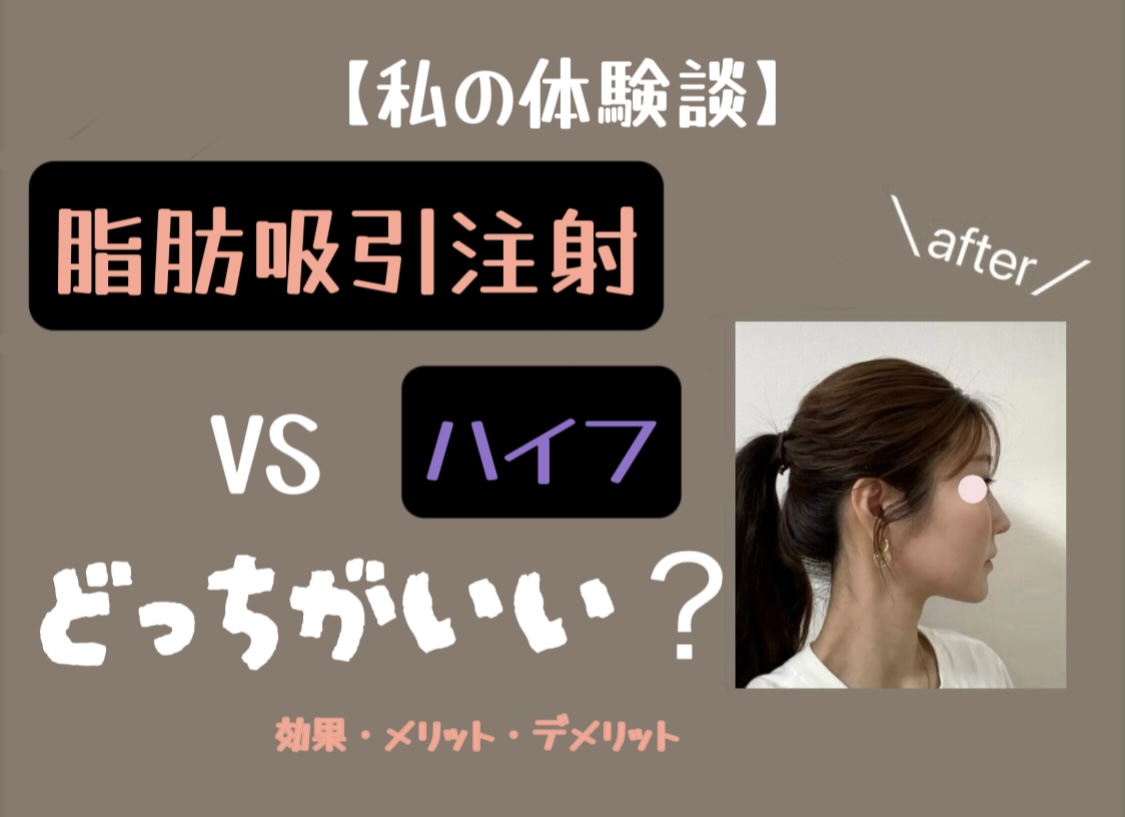 riposuction-injection-hifu-which-is-better